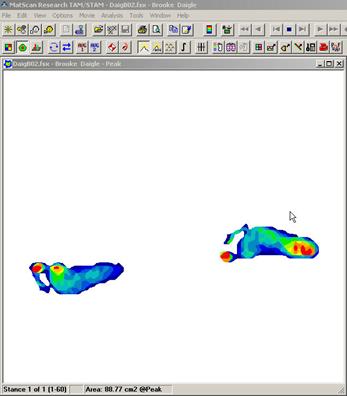 pediatric-hrmat-2-footstrikes.jpg